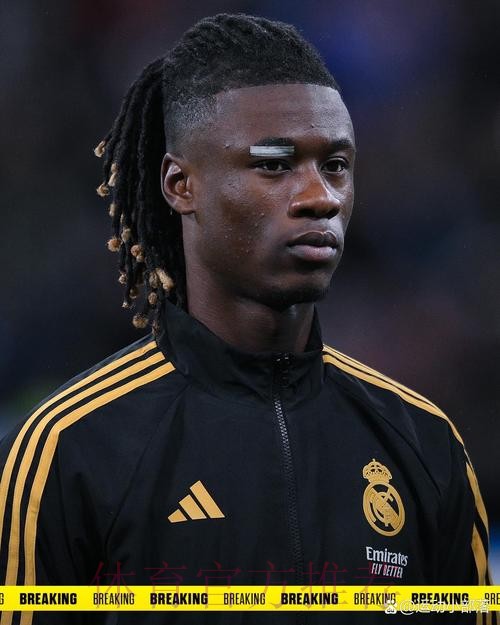 卡马文加预计伤缺3周 皇马将检查他韧带是否受伤 卡马文加预计伤缺3周 皇马将检查他韧带是否受伤